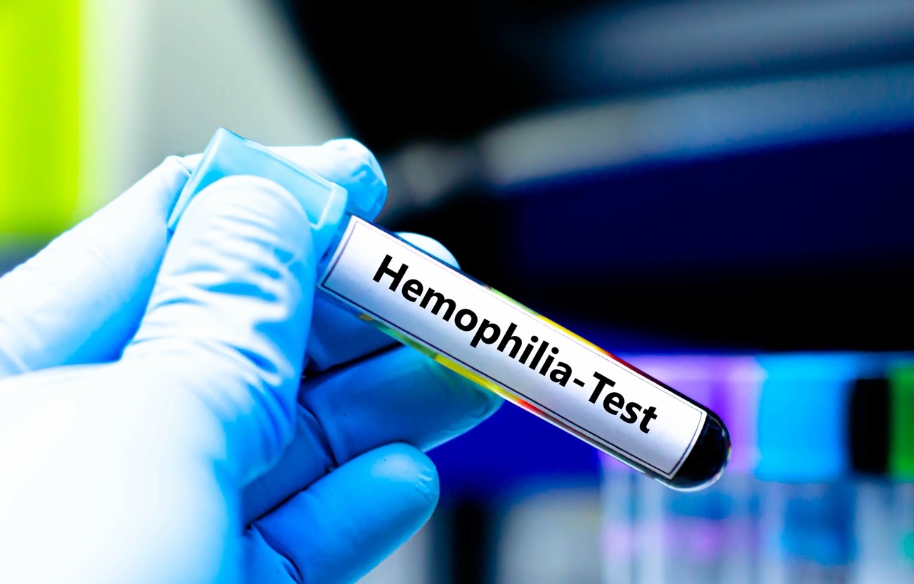Blood sampling tube for hemophilia test analysis. Blood sampling tube for hemophilia test analysis.